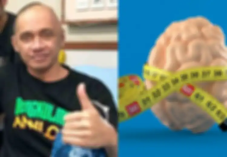 Agung Hercules Idap Kanker Otak: Ukuran Otak Bisa Memprediksi Risiko Kanker Otak, Ini Penjelasannya!