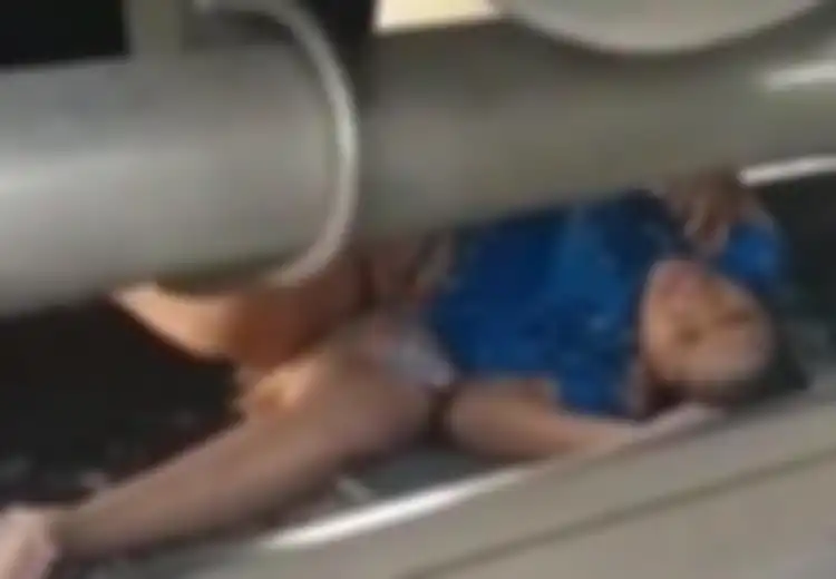 Ditabrak Kereta Api, Remaja Ini Selamat Meski Kakinya Sempat Masuk ke Kolong Kereta Api