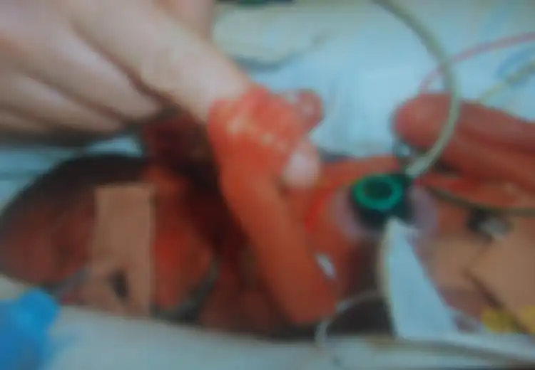 Dokter Pasrah dan Angkat Tangan Untuk Selamatkan Bayi Ini, Saat Semua Orang Menyerah, Hal Ajaib Justru Terjadi 