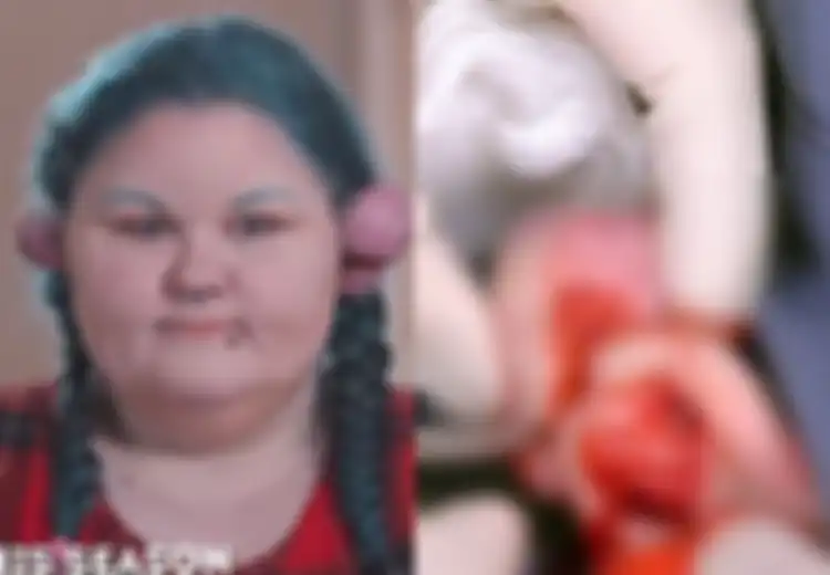 Lakukan Tindik di Bagian Tak Biasa, Telinga Wanita Ini Ditumbuhi Benjolan Daging Seberat Hampir Setengah Kilogram