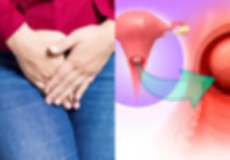 Jadi Kanker Keempat paling Sering Dialami Wanita, Ini Gejala Kanker Serviks yang Harus Diwaspadai