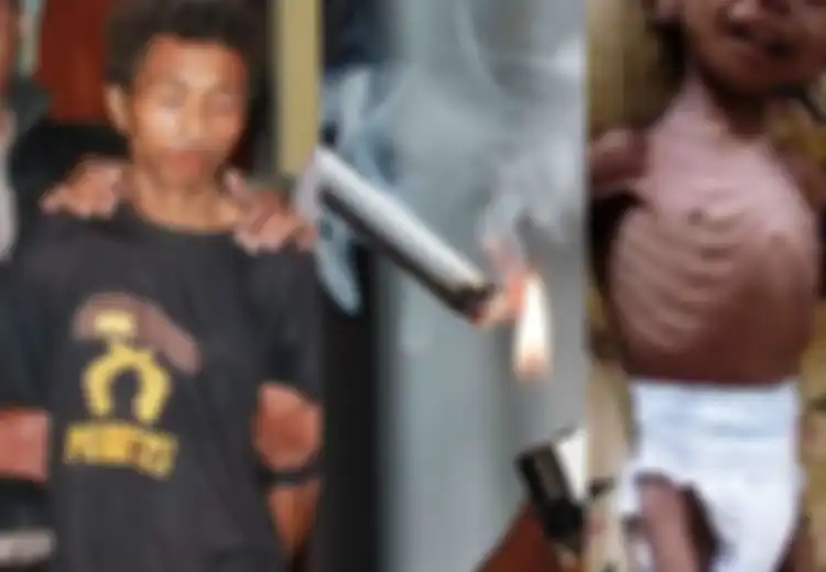Kisah Pilu DDS, Bayi 2 Tahun Penderita Gizi Buruk yang Sering Disulut Rokok dan Dipukuli Hingga Patah Tulang oleh Ayahnya Hanya karena Sering Menangis