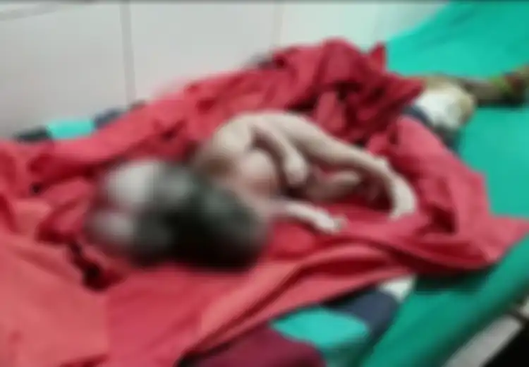 Tak Alami Komplikasi Selama Kehamilan, Seorang Wanita Melahirkan Bayi Perempuan dengan 'Tiga Kepala' yang Memprihatinkan
