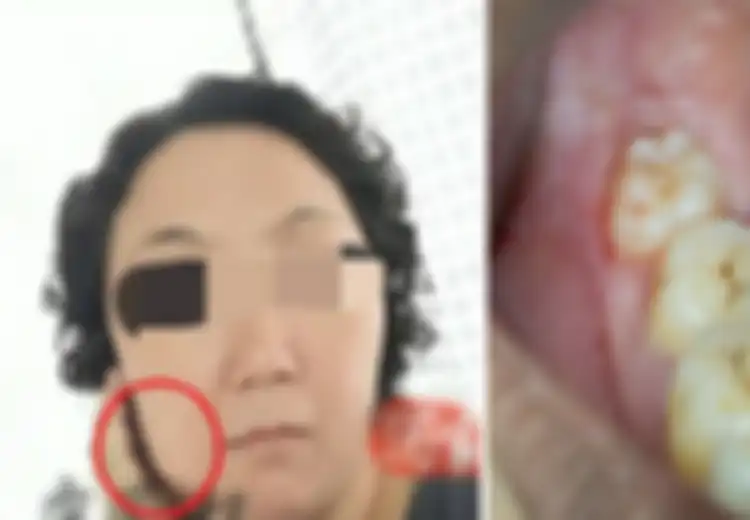 Wanita Meninggal 5 Hari Usai Cabut Gigi Bungsu, Keluarganya Tak Terima Dokter Sebut Penyebab Kematiannya Karena Tumor