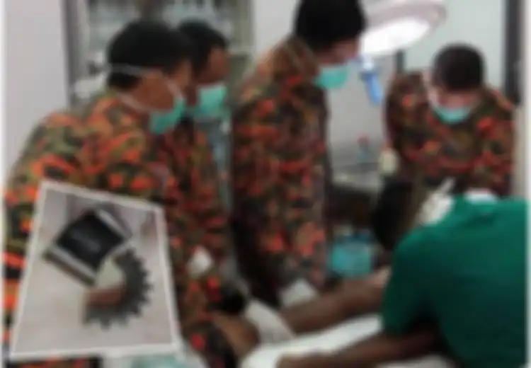 Kisah Viral Organ Vital Pria Tersangkut 'Gear Persneling', Petugas Sampai Kebingungan Melepaskannya Akhirnya Lakukan Cara Ini