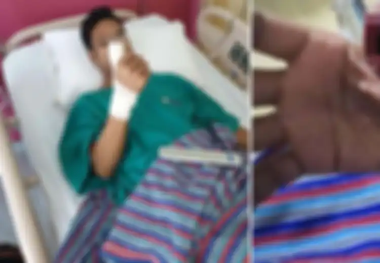 Sering Sentuh 'Tempered Glass' yang Retak, Jempol Pria Ini Alami Kondisi Mengerikan Hingga Dibawa Ke Rumah Sakit
