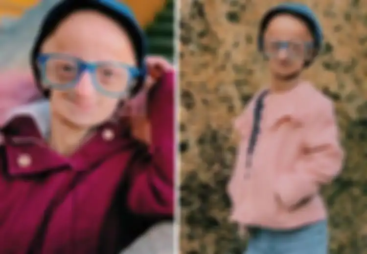 Menua Tujuh Kali Lebih Cepat, Ini Kisah Claudia, Wanita Berusia 20 Tahun yang Terlihat Seperti Berusia 140 Tahun