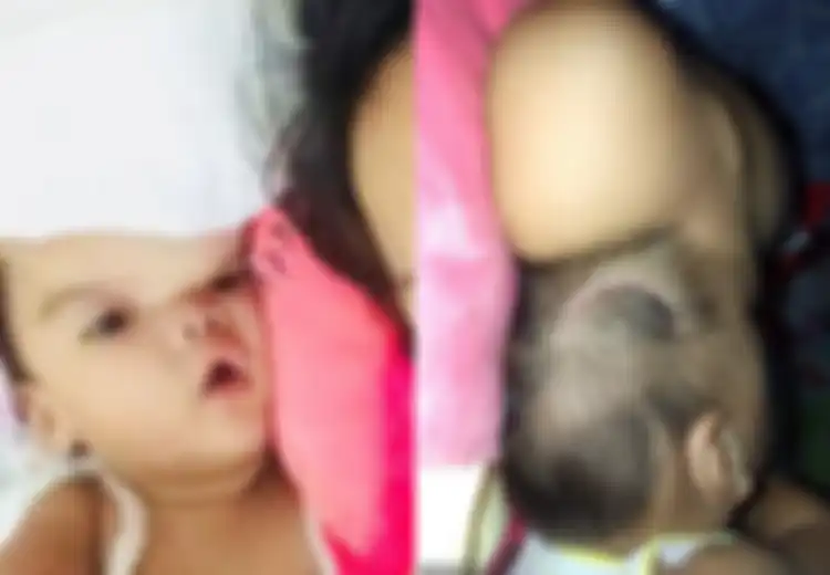 Kepala Bayi 11 Bulan Ini Membengkak Seperti Balon Hingga Kesulitan Melihat, Keluarga Mati-matian Cari Ahli Bedah