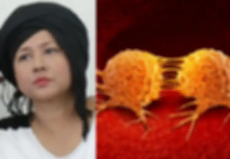 Ria Irawan Alami Metastasis: Faktanya, Kebiasaan Tidur Masyarakat Indonesia Ini Juga Bisa Bikin Sel Kanker Menyebar dengan Cepat dalam Tubuh