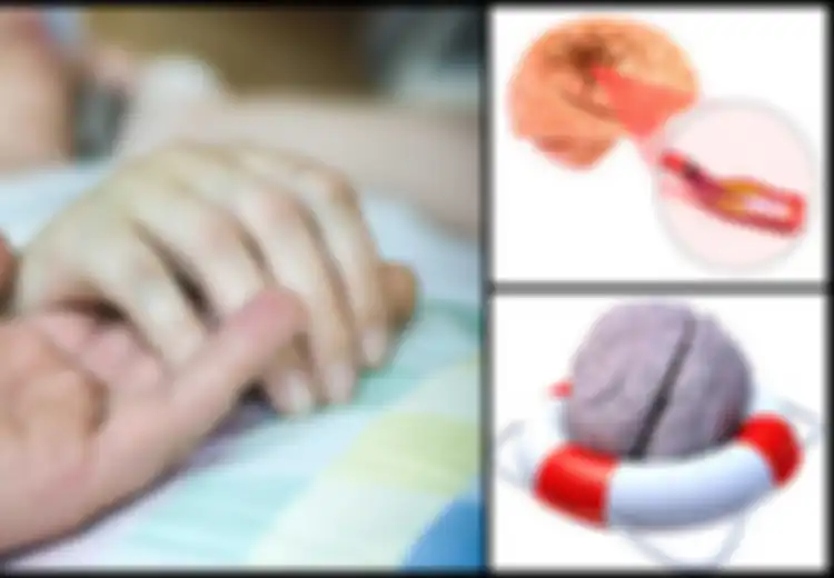 6 Perawatan Alternatif Alami untuk Atasi Stroke, Anda Dapat Melakukan Perubahan Gaya Hidup!