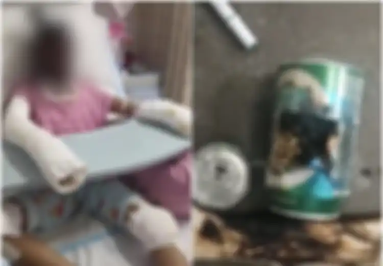 Berhati-hatilah! Seorang Remaja Tewas Akibat Memasak Popcorn Pakai Kaleng Usai Meniru Video Tutorial di Internet
