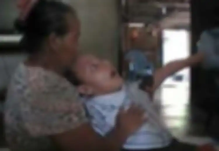 Puluhan Warga di Sebuah Pemukiman di Bali Derita Lumpuh Otak, Apa yang Terjadi?