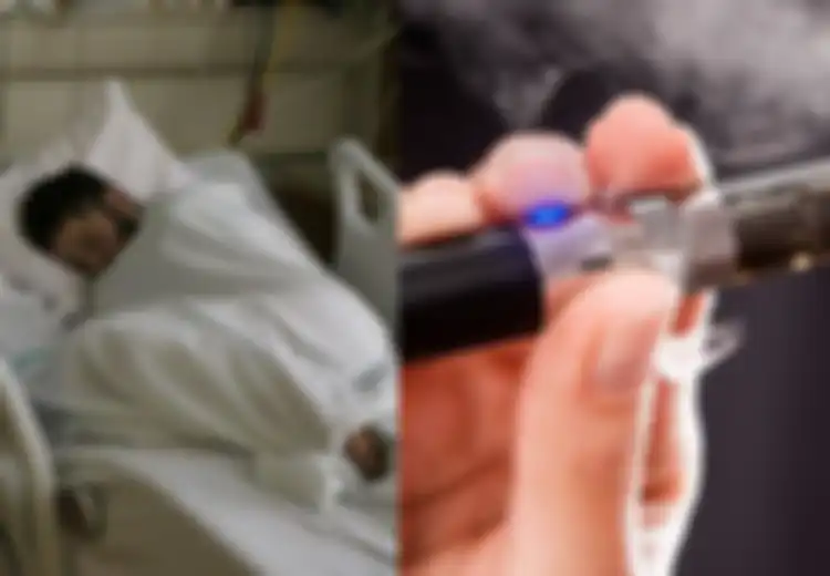 Paru-paru Pengguna Vape Menua 4 Kali Lipat Lebih Cepat, Kandungan pada Racikan Ini Jadi 'Tersangka Utama'