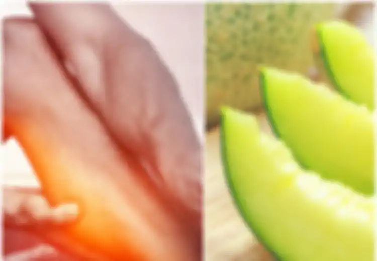 Tak Perlu Tersiksa Lagi, Atasi Kram Otot dengan 5 Makanan Ini, Salah Satunya Melon
