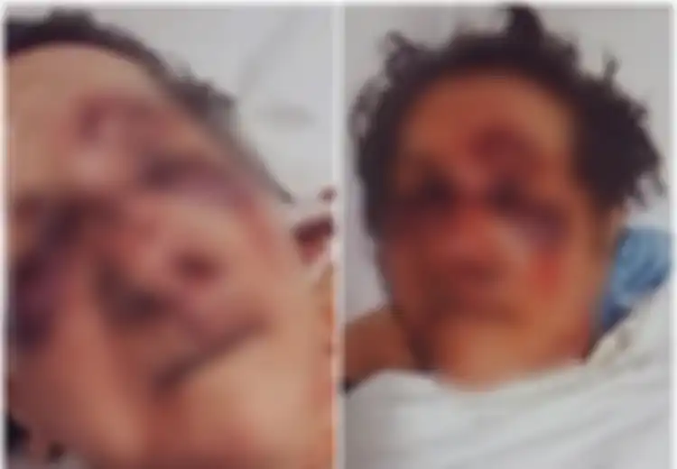 Seorang Anak Tuduh Staf Panti Jompo Aniaya Ibunya hingga Babak Belur dan Hidungnya Patah, Begini Kronologisnya
