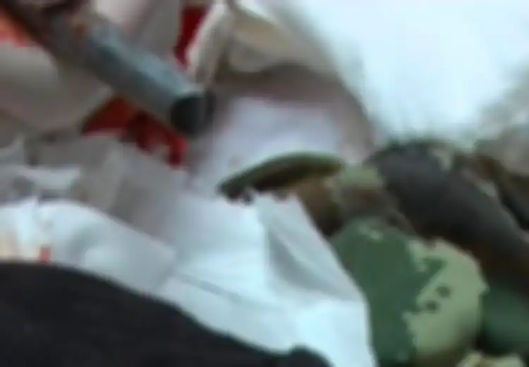 Terjatuh dan Batang Besi Menusuk Hidung hingga Tembus ke Tempurung Tengkoraknya, Pria Ini Selamat dengan Ajaib