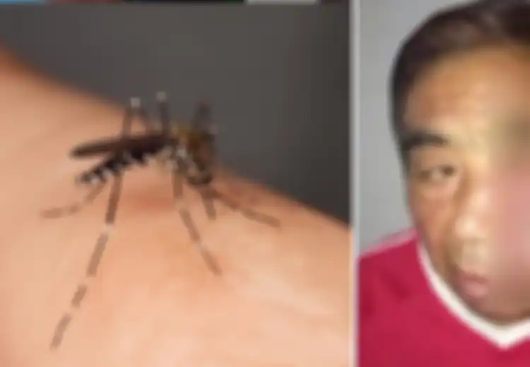 Jangan Sembarangan Menggaruk Bekas Gigitan Nyamuk, Jika Tak Ingin Wajah Anda Berubah Memilukan Seperti Dialami Pria Ini