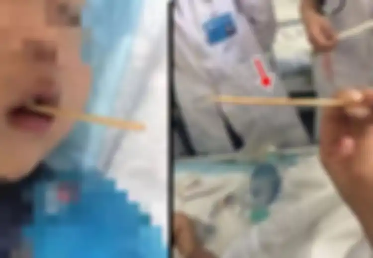 Sering Beli Makanan yang Disajikan Dengan Cara Ditusuk? Hati-hati, Anak Ini Alami Hal Mengerikan Setelah Diberi Makanan Tersebut