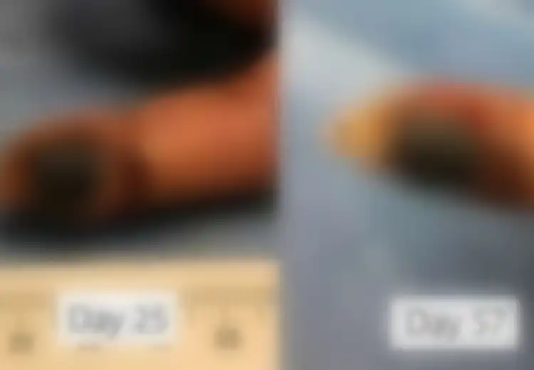 Seorang Pekerja Lab Tak Sengaja Menusuk Dirinya Dengan Virus, Tapi Dia Tak Tau Virus Jenis Apa yang Menginfeksinya