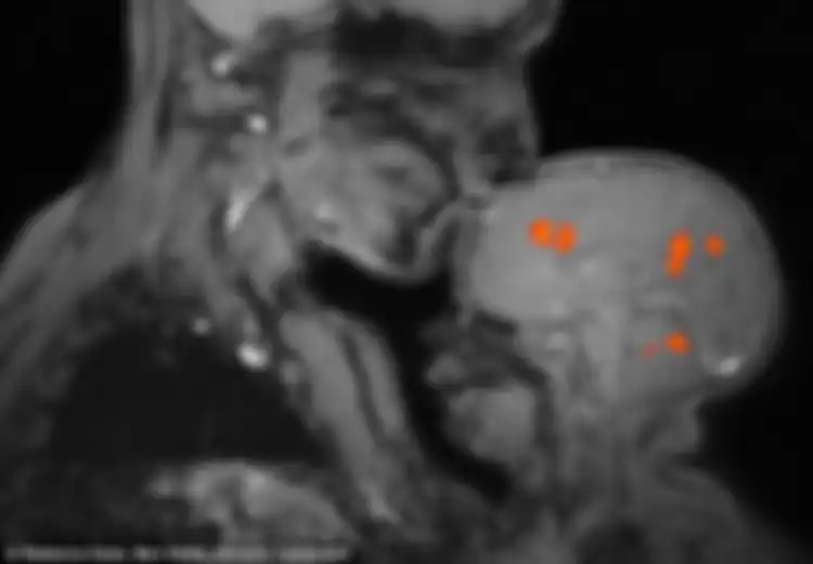 Foto MRI Otak Ini Diklaim Jadi 'Bukti' Begitu Eratnya Kasih Sayang Ibu dan Anak, Kok Bisa?