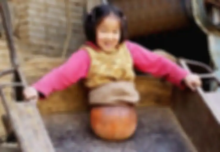 Kisah Gadis Berkaki 'Bola Basket',  Setelah 19 Tahun Berlalu Kini Kondisi Gadis Ini Begitu Mengagumkan