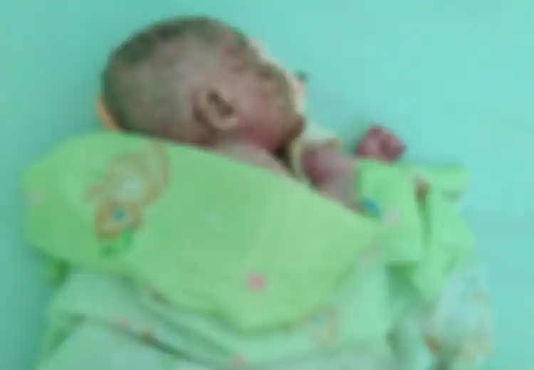 Bayi Ini Tersiksa Karena Kulitnya Keras Seperti Plastik dan Mengelupas hingga Berdarah, Simak Faktor Penyebab Dermatitis Seboroik dan Cara Merawatnya