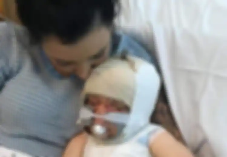 Kasus Balita Tersiram 9 Liter Air Mendidih Saat Ibunya Masak Sambil Lakukan Video Call, Ini yang Harus Dilakukan untuk Menangani Luka Siraman Air Panas