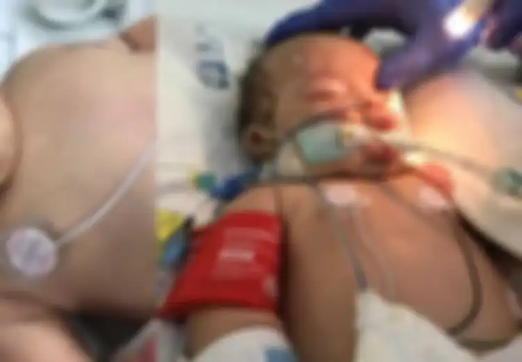 Bayi Ini Koma Setelah Diguncang Terlalu Kencang oleh Ayahnya: Mengenal Sindrom Bayi Terguncang yang Bisa Sebabkan Pendarahan Retina, Koma, Bahkan Kematian
