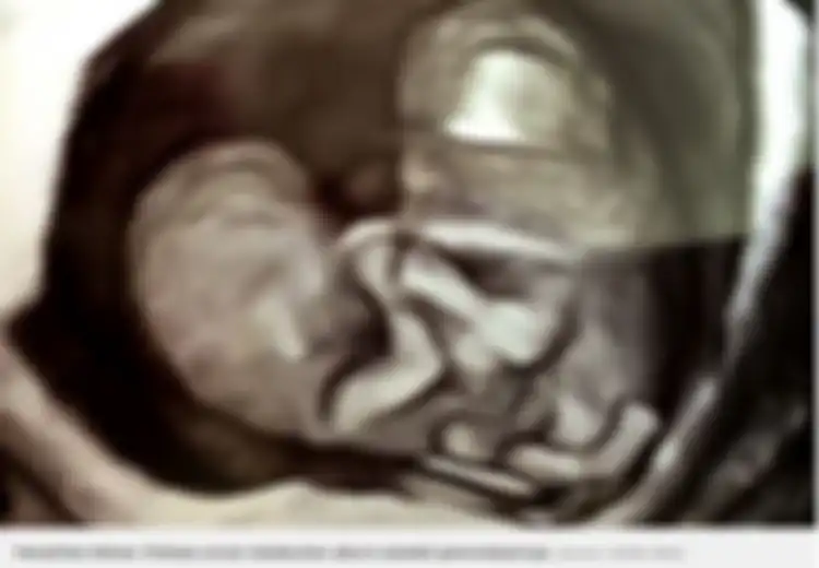 Menolak Saran Aborsi Dokter, Wanita Ini Mantap Lahirkan Bayinya Meski Kondisinya 'Menyedihkan' Tiga Tahun Berlalu Beginilah Kehidupan Anak-anak Malang Ini