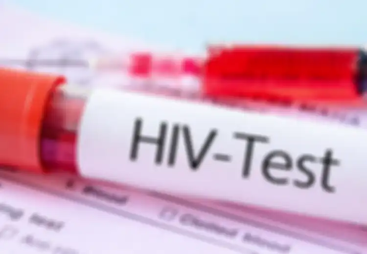 Dokter Dibuat Tercengang Dengan Kasus Langka Ini, Seorang Wanita Terinfeksi HIV Tak Disangka Sembuh Tanpa Bantuan Obat, Inilah yang Terjadi pada Virusnya