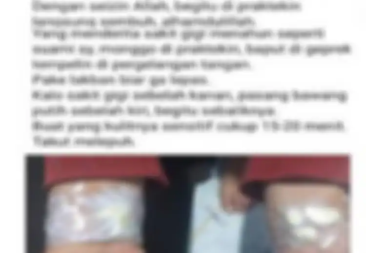 Viral Tempel Bawang Putih di Tangan Bisa Atasi Sakit Gigi, Benarkah Bisa? Ini Penjelasan Dokter