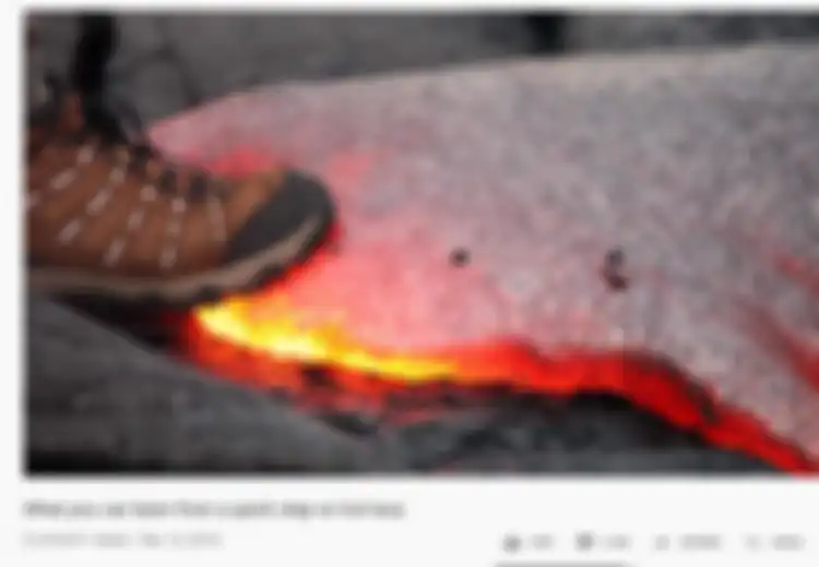 Kawah Gunung Karangetang Terus Keluarkan Lava: Ini yang Terjadi Jika Tubuh Kita Terkena Lava, Kaki Pria Ini Sampai Hancur!