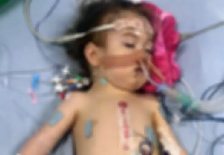 Bayi Mungil Ini Lahir dengan Empat Kelainan Sekaligus, Termasuk Jantung yang Salah Tempat, Kondisinya Kini Bikin Dokter 'Geleng-geleng'