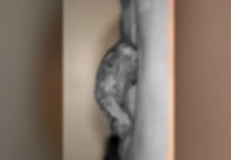 Tumbuh Tanduk hingga Sepanjang 14 Cm, Ternyata Biasa Muncul di Daerah yang Terpapar Matahari dan Biasa Menyerang Lansia, Begini Tanda Awalnya 
