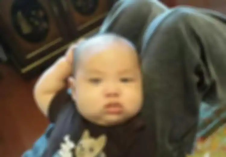 Bayi Itu Terus Menyentuh Kepalanya, Orang Tuanya Mengira Hanya Gatal, Tetapi Karena Terlalu Sering Orang Tuanya Membawanya ke Dokter, Ternyata Situasinya Gawat