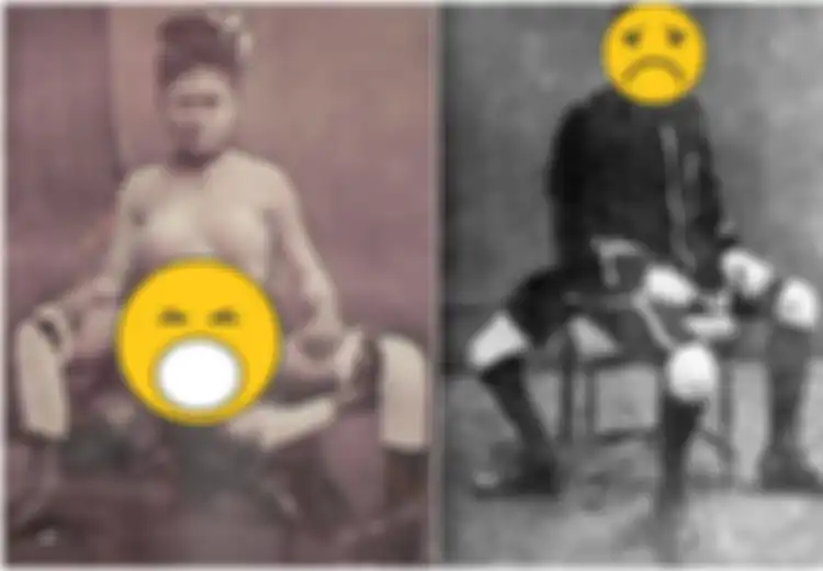 Kisah Blanche Dumas, Pelacur dengan Dua Organ Kelamin yang Terobsesi Berhubungan Intim Akhirnya Bertemu Pria yang Juga Memiliki Dua Alat Kelamin