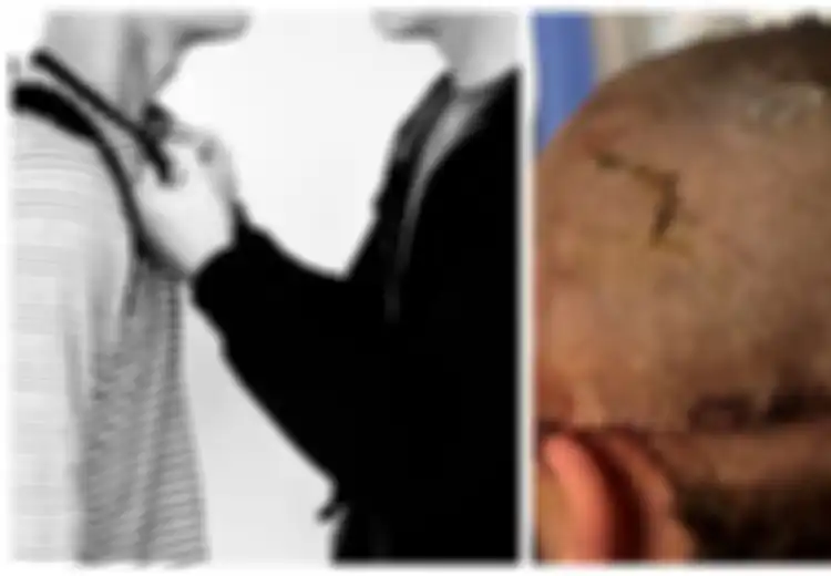 Miris, Dua Remaja Serang Temannya Pakai Tongkat Berpaku Tirukan Adegan Serial Televisi Sebabkan Korban Cacat Seumur Hidup, Orangtua Tak Boleh Diam, Ini yang Bisa Dilakukan sebagai Pencegahan