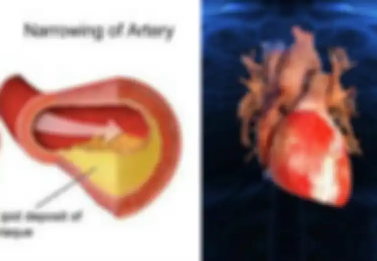 Cegah Stroke dan Penyakit Penyumbatan Pembuluh Darah Lain Dengan Konsumsi Makanan-makanan Ini, Bisa Bersihkan Pembuluh Darah!