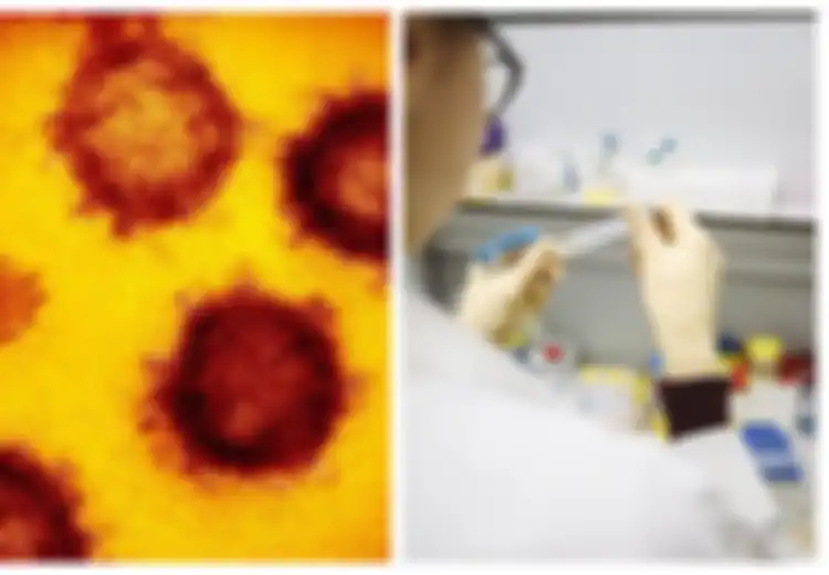 Ilmuwan Ungkap Virus Corona Bisa Dihindari 95 Persen, Namun Akibat Tindakan China Ini Malah Menyebar Ke Seluruh Dunia, Sebabkan Banyak Pemimpin Dunia Marah Besar Pada China