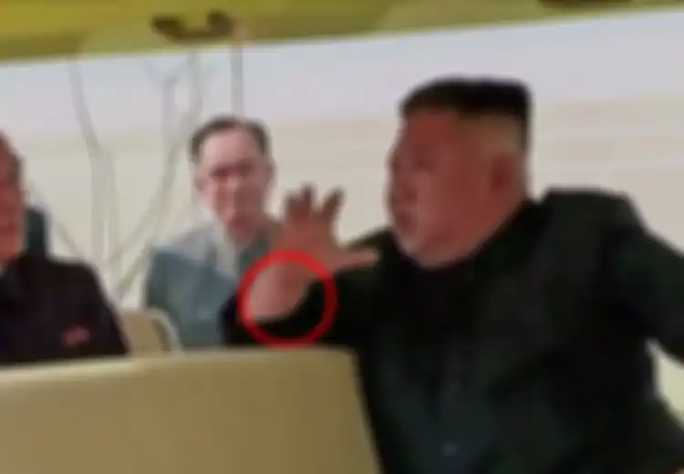 Tanda Misterius di Pergelangan Tangan Kim Jong Un setelah Muncul ke Publik Jadi Perhatian, Ini Kata Profesional Medis AS