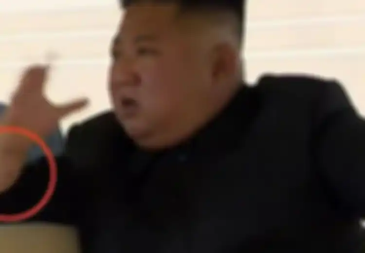 20 Hari Menghilang dari Publik, Tanda di Pergelangan Tangan Kim Jong Un Akhirnya Ungkap ke Mana Saja Sang Diktator Selama Ini
