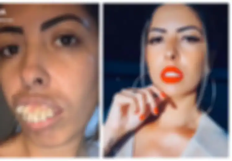 Heboh! Beredar Video Perubahan Drastis Wanita yang Menikah dengan Ahli Bedah Gigi, Tapi Ini Fakta di Baliknya yang Bikin Emosi, Apa yang Terjadi Sebenarnya?