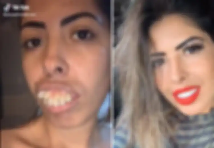 Bikin Netizen Terkesima dengan Transformasi Gigi yang Mengagumkan, Rupanya Wanita ini Sembunyikan Hal yang Tak Kalah Mengejutkan