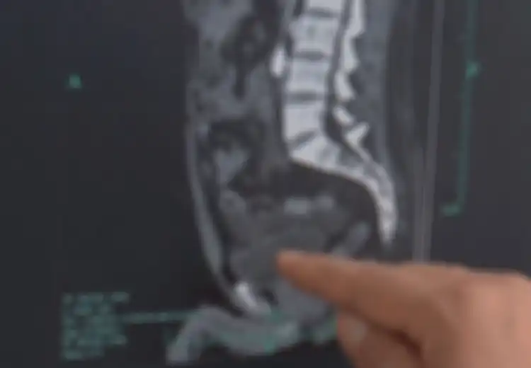 Gara-gara Kebanyakan Minum Minuman Ini, Seorang Pria Kandung Kemihnya 'Meledak', Dokter Ungkap Penyebabnya Seringkali Kita Lakukan