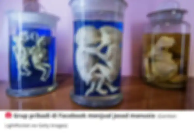 Ada Janin Bayi, Potongan Organ Hingga Mayat Manusia, Inilah Barang-barang Mengerikan yang Dijual di Pasar Gelap Harganya Ada yang  Mencapai Rp1,7 Miliar
