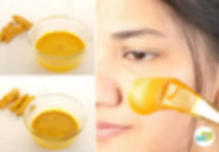 Buat Campuran Kunyit dan Madu untuk Atasi Jerawat Sampai Kumis Tipis pada Wanita, Ini Caranya