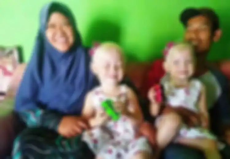 Di Wonogiri Diburu untuk 'Selfie', di Tanzania Anak Albino Diburu untuk Diambil Bagian Tubuhnya, Dijual Hingga Ribuan Dollar karena Dipercaya Beri Kekuatan Ini