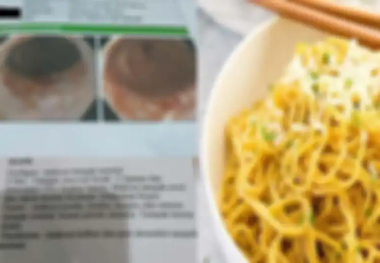 Waspadalah! Sering Tiduran Usai Makan & Santap Ratusan Mie Instan dalam 3 Minggu, Pria Ini Alami Hal Tak Terduga