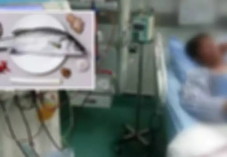 Bikin Syok! Hanya Gara-gara Makan Ikan Bagian Ini, Seorang Pria Divonis Dokter Idap Gagal Ginjal, Waspada! Lebih Baik Hindari Mulai Sekarang