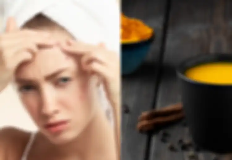 Miliki Masalah dengan Jerawat di Wajah? Coba Atasi dnegan 5 Minuman Ini yang Ternyata Ampuh Atasi Masalah Jerawat